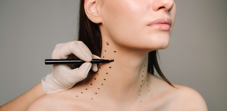 Halsstraffung (Necklift)