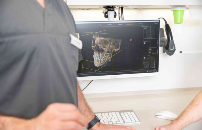 Ein Computerbildschirm im Behandlungszimmer zeigt die 3D-Grafik eines Kiefers
